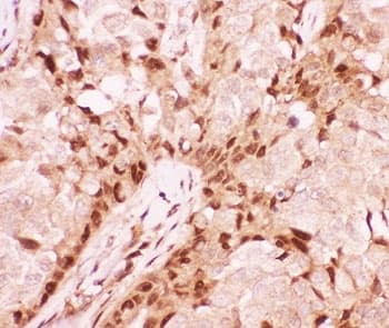 Polyclonal Rabbit anti-Human AML1 / RUNX1 Antibody (aa227-257, IHC, WB)