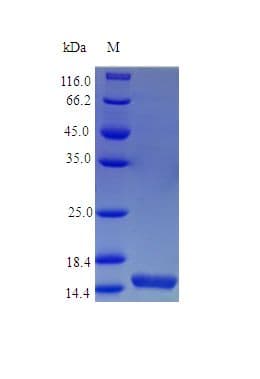 Mouse IL21 Protein (Recombinant)