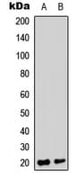 TRAPPC3 Antibody (C-Terminus)