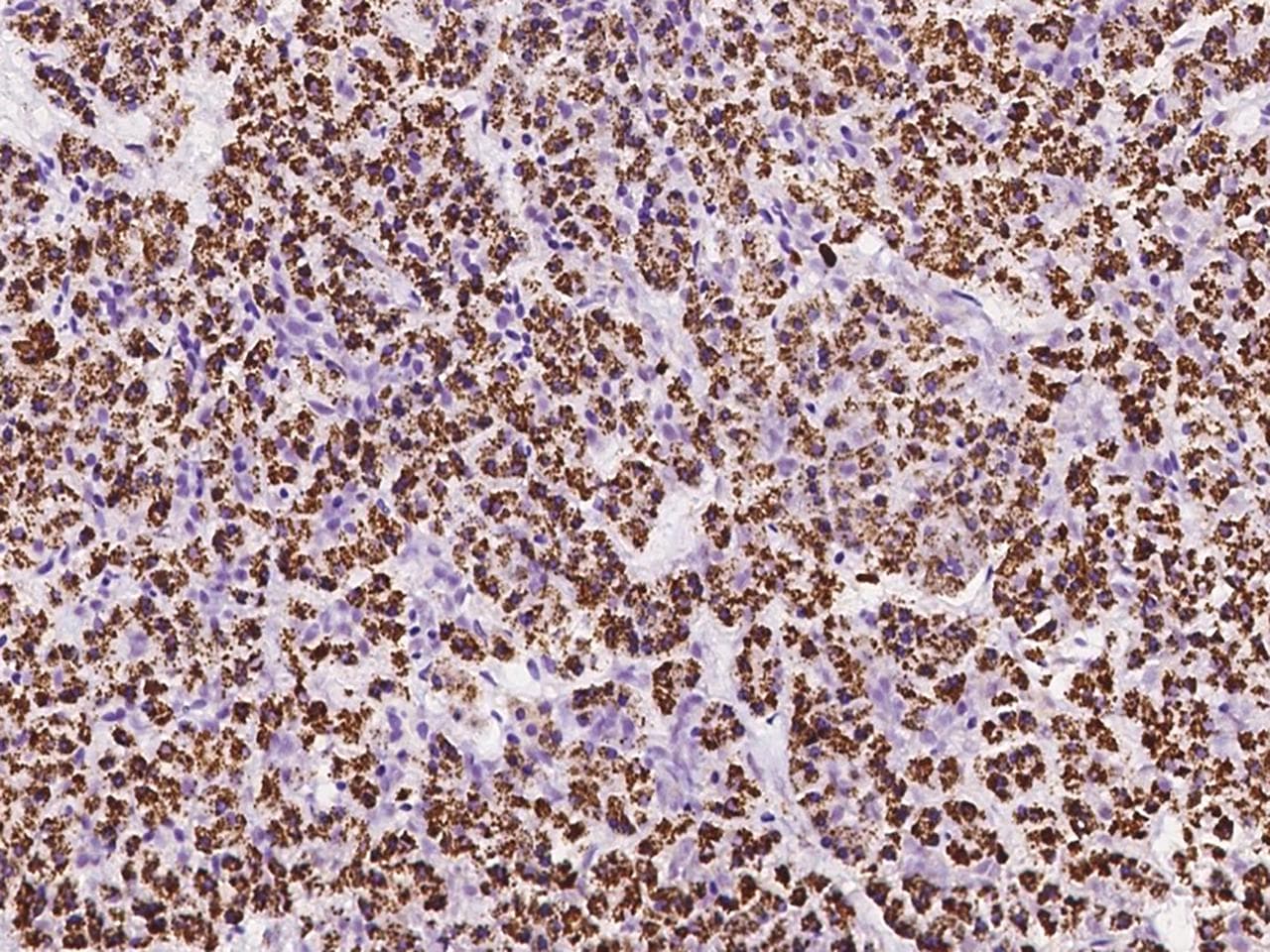 Polyclonal Rabbit anti-Human ZDHHC4 Antibody (IHC)