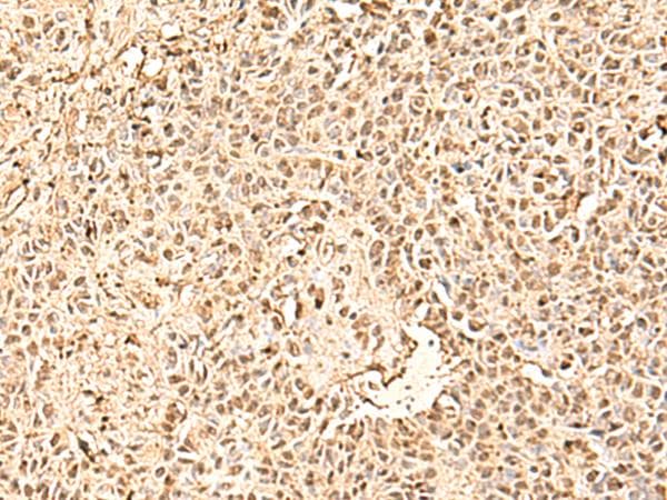 Survival Motor Neuron Domain Containing 1 (SMNDC1) Antibody