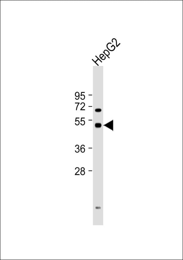 CYP2W1 Antibody