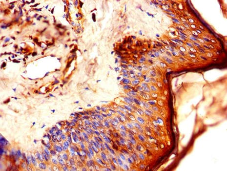 LCE1B Antibody