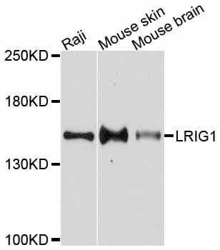 Polyclonal Rabbit anti-Human LRIG1 Antibody (WB)
