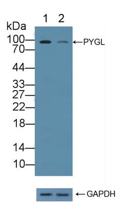 Polyclonal Rabbit anti-Human PYGL Antibody (aa370-538, WB)