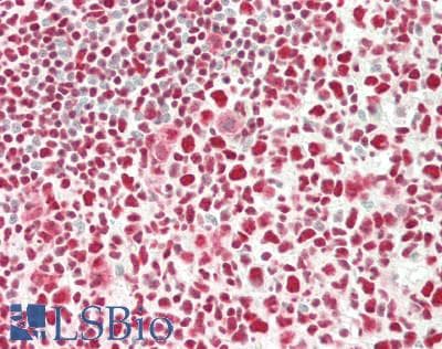 PathPlus™ FOS / c-FOS Antibody (aa283-295)