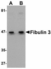 IHC-plus™ Fibulin-3 / EFEMP1 Antibody