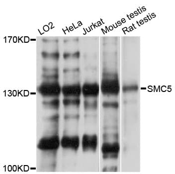 Polyclonal Rabbit anti-Human SMC5 Antibody (WB)