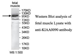 EMC1 Antibody (aa316-512)