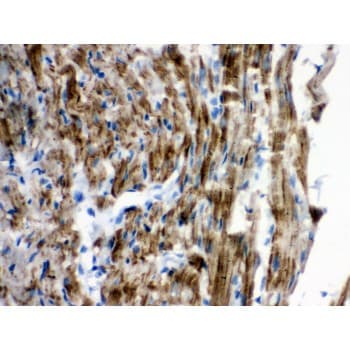 VDAC1 / PORIN Antibody (aa154-181)