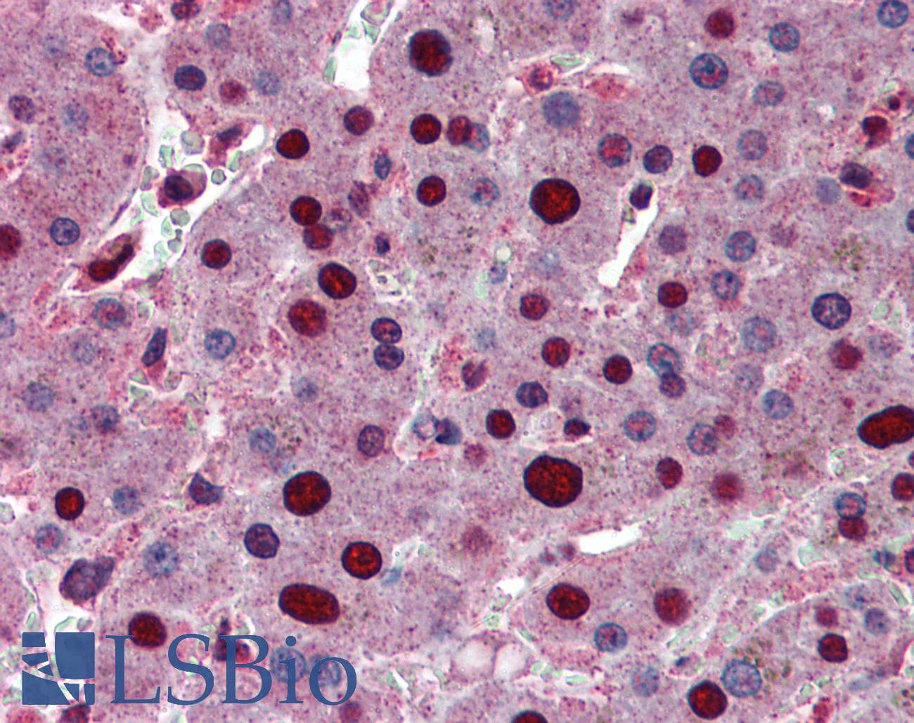 IHC-plus™ Monoclonal Mouse anti-Human PHAP1 / ANP32A Antibody (clone 2G11-4A5, IHC, IF, WB)