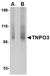 Polyclonal Rabbit anti-Human Transportin-SR / TNPO3 Antibody (WB)