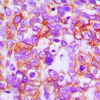 ABCB5 Antibody