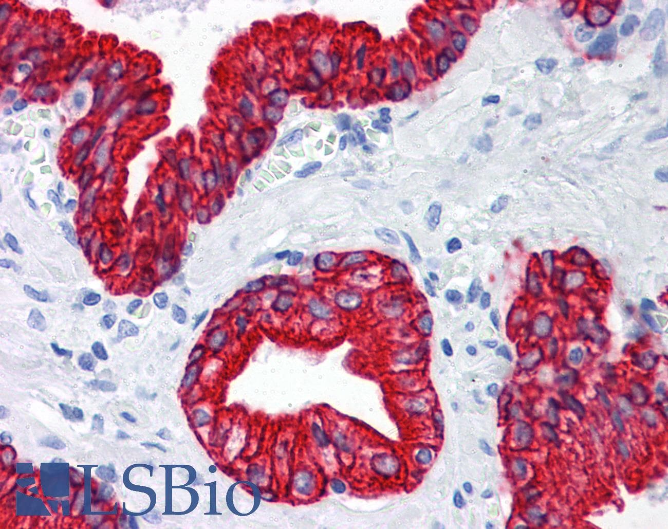 PathPlus™ Pan Cytokeratin Antibody (clone 7H8C4)