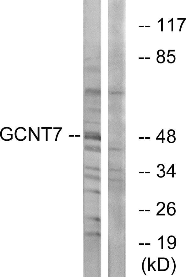 GCNT7 Antibody