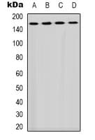 Polyclonal Rabbit anti-Human PLCG1 Antibody (Internal, IHC, WB)