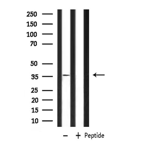 P2RY6 / P2Y6 Antibody