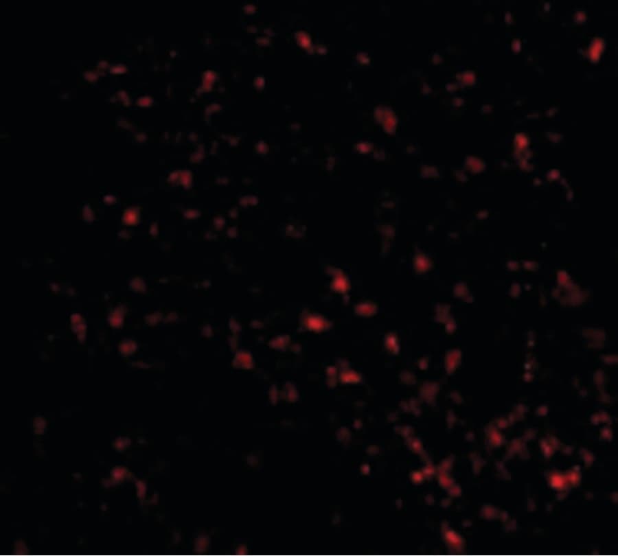 IHC-plus™ Polyclonal Rabbit anti-Human FEM1B Antibody (IHC, IF, WB)