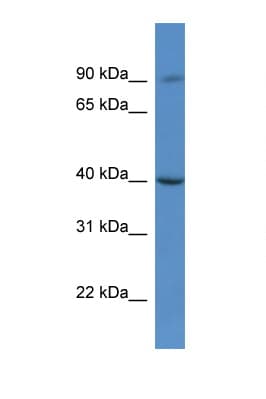 Polyclonal Rabbit anti-Human C9orf64 Antibody (aa266-315, WB)