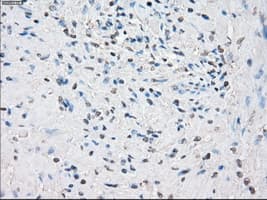 Monoclonal Mouse anti-Human CYPOR / POR Antibody (clone OTI1B11, IHC, IF, WB)
