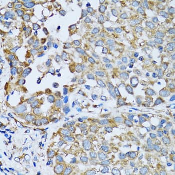 Polyclonal Rabbit anti-Human RARS Antibody (IHC, IF, WB)