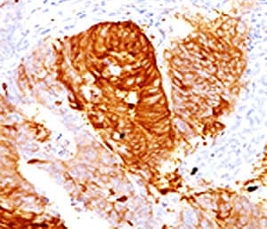 ALDH1A1 / ALDH1 Antibody (clone AHDH1-1)