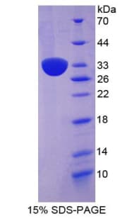 Mouse ADCY1 / Adenylate Cyclase 1 Protein (Recombinant His, N-Terminal)