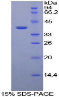 Bovine FGL1 / Hepassocin Protein (Recombinant His-S)