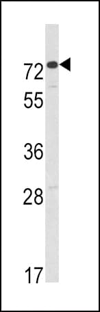 AMHR2 / MISRII Antibody (aa374-402)