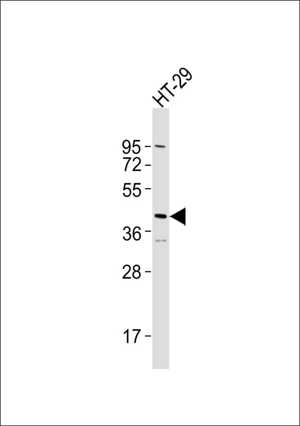SERPINB5 / Maspin Antibody