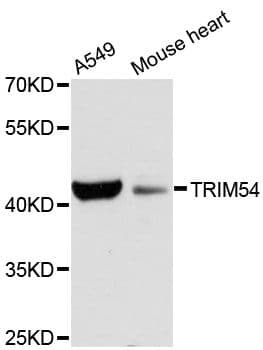 Polyclonal Rabbit anti-Human TRIM54 / MURF Antibody (WB)