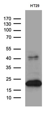 CIB1 / KIP Antibody (aa2-191, clone OTI1D7)