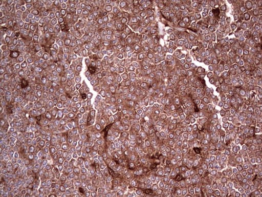 Monoclonal Mouse anti-Human LGALS3 / Galectin 3 Antibody (clone OTI2F1, Carrier-free, IHC, WB)