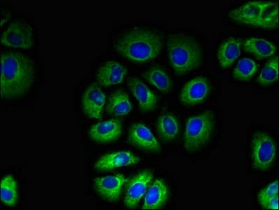 Polyclonal Rabbit anti-Human TAS1R2 / T1R2 Antibody (IF)