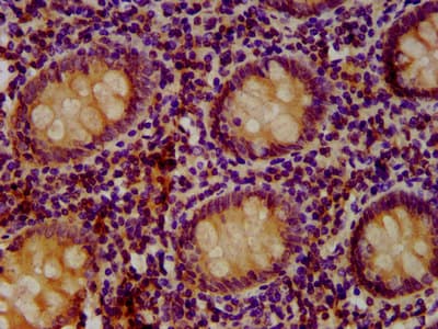 SETD3 Antibody