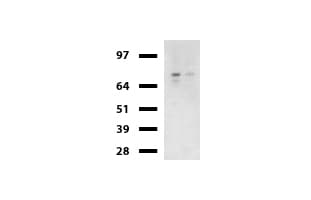 CTNNB1 / Beta Catenin Antibody (clone UMAB15)