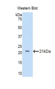 IL11RA Antibody (aa59-217, Biotin)