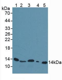 B2M / Beta 2 Microglobulin Antibody (aa22-119)