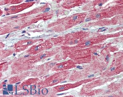 IHC-plus™ Polyclonal Rabbit anti-Human SKI Antibody (aa678-728, IHC, WB)