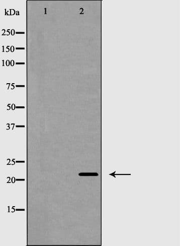 Polyclonal Rabbit anti-Human CLDN4 / Claudin 4 Antibody (IHC, WB)