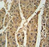 PRDX6 / Peroxiredoxin 6 Antibody (aa103-132)