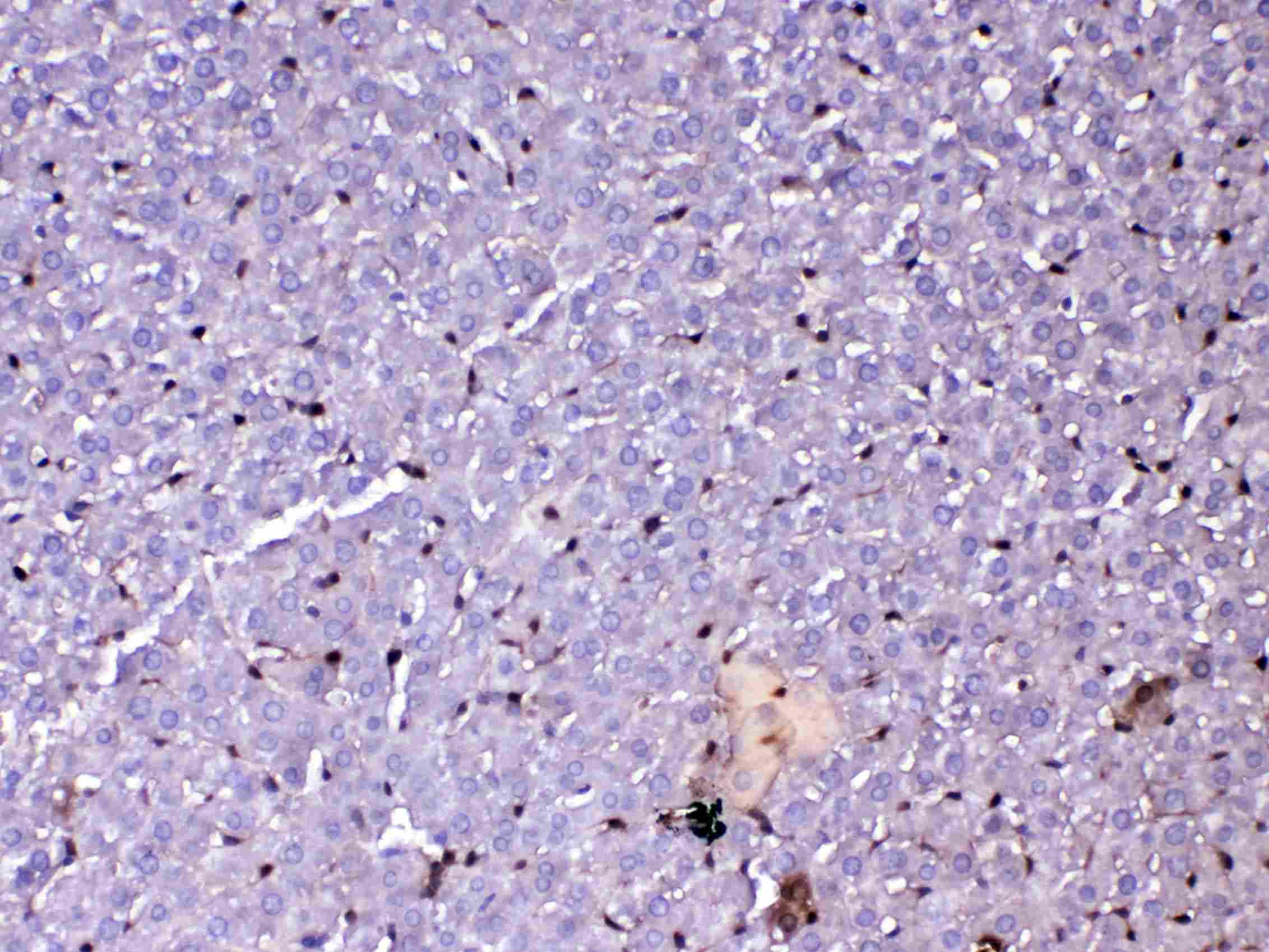 GSTP1 / GST Pi Antibody