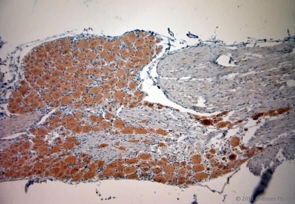 CACNA2D1 Antibody (aa600-650)