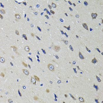 RBP4 Antibody