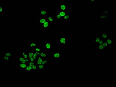 Polyclonal Rabbit anti-Human HIST1H1B Antibody (phospho-Ser188, IF, WB)