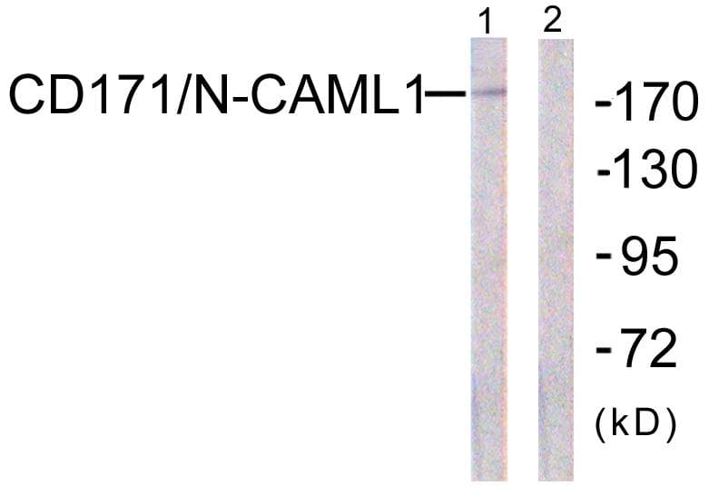 L1CAM Antibody (p1181)