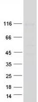 Human GRIN1 / NMDAR1 Protein (Recombinant Myc-DDK (Flag))