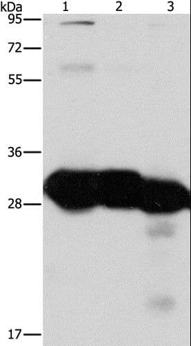 KHK / Ketohexokinase Antibody