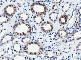 QPRT Antibody (clone OTI4E6)