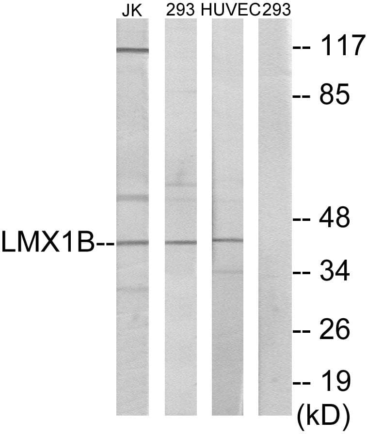 LMX1B Antibody